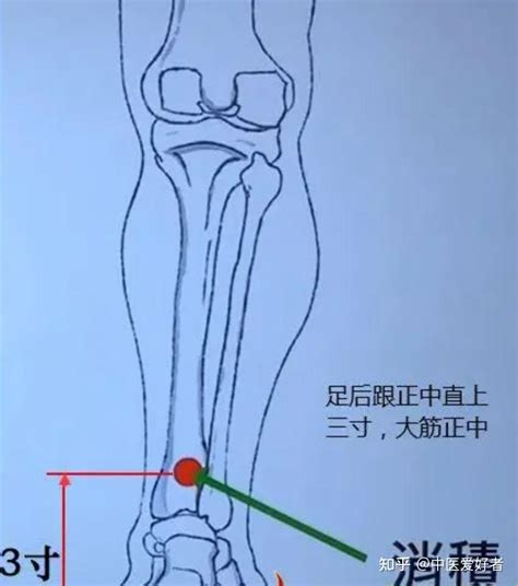 消積穴